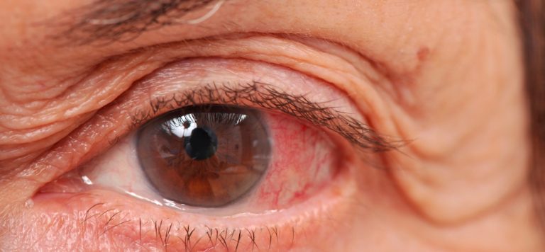 Mata Sehat di Usia Tua: Tips dan Perawatan yang Perlu Diketahui