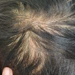 5 Tips Menutrisi Rambut agar Tumbuh Lebih Cepat dan Sehat