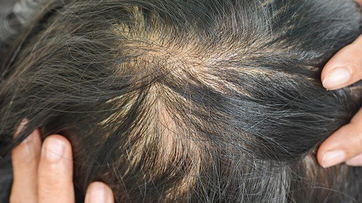5 Tips Menutrisi Rambut agar Tumbuh Lebih Cepat dan Sehat