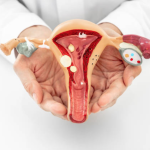 10 Tanda Gangguan Kesehatan Reproduksi yang Perlu Diwaspadai