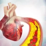 7 Cara Mengurangi Kolesterol untuk Kesehatan Jantung
