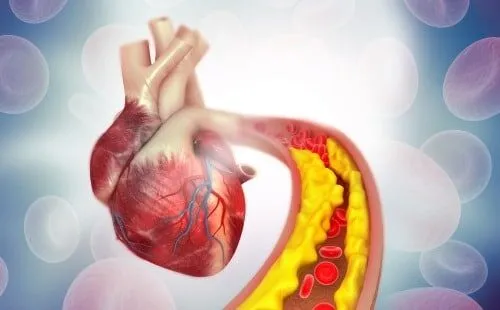 7 Cara Mengurangi Kolesterol untuk Kesehatan Jantung