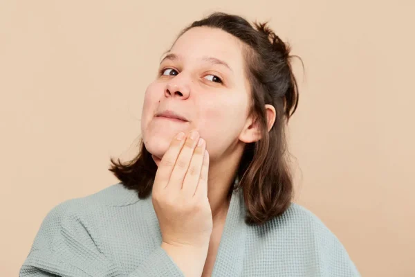 5 Cara Mencegah Acne Muncul Kembali di Wajah Anda