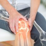 5 Kebiasaan Sepele tapi Merusak Lutut
