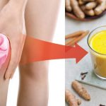 10 Herbal Alami yang Baik untuk Sendi Lutut