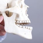 10 Cara Menghindari Rahang Bergeser atau Dislokasi