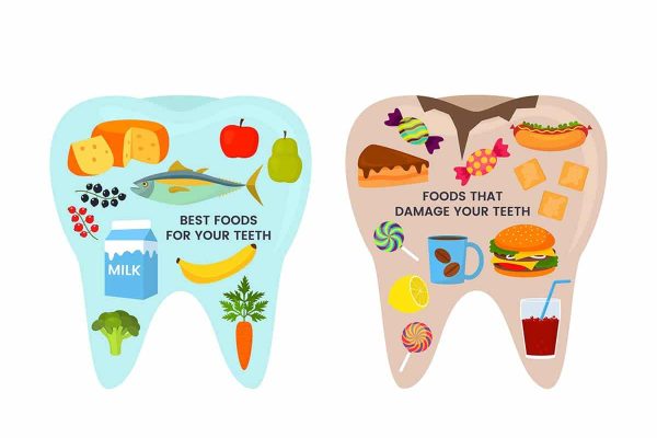 7 Jenis Makanan dan Minuman yang Harus Dihindari untuk Gigi Sehat