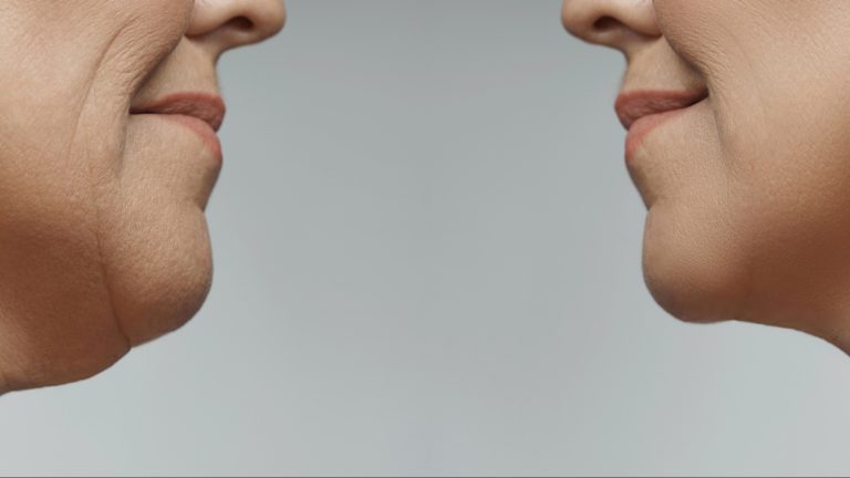 7 Cara Alami Membentuk Dagu agar Terlihat Lebih Tajam